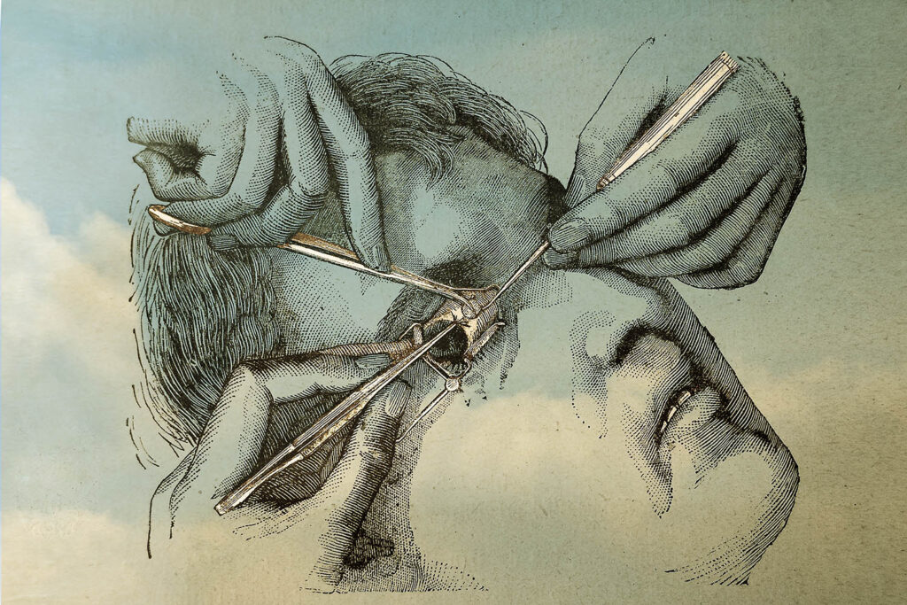 Augenchirurgie